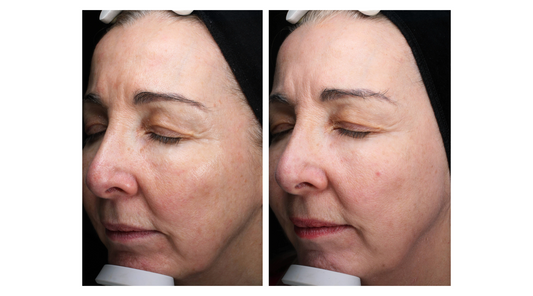 Vital Results: A Clearer, Fresher and Smoother Complexion
