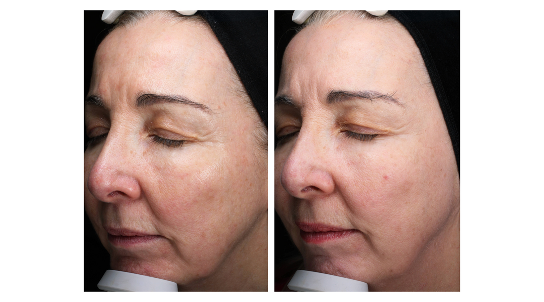 Vital Results: A Clearer, Fresher and Smoother Complexion